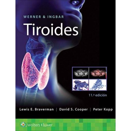 Werner & Ingbar. Tiroides 9788418257605