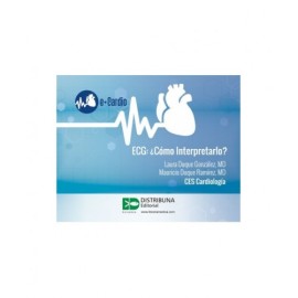 ECG: ¿Cómo interpretarlo?