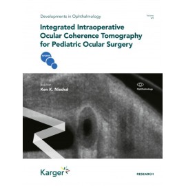 Integrated Intraoperative Ocular Coherence Tomography for Pediatric Ocular Surgery